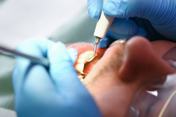 Best Chipped Tooth Repair Near Me  in Barstow, CA